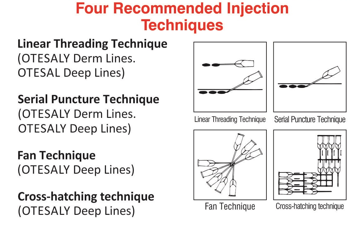 Four recommended injection techniques